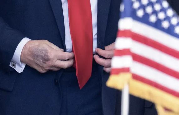 އަތުގައި ކުރަގަނޑެއް ނެގީ އެސްޕިރިން ކާތީ: ޓްރަމްޕު