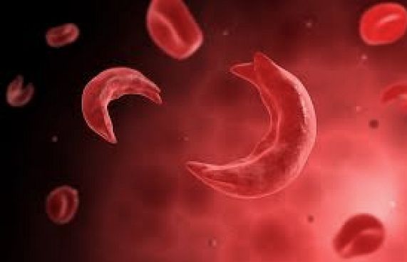 ލޭގެ އެހެން ބައްޔެއް، ސިކްލް ސެލް އަށް ސަމާލުވޭ!