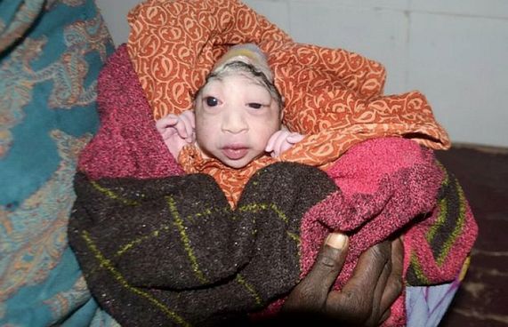 އައިބުކަން ހުރި ދަރިއަކަށް ގާތުން ދޭން އިންކާރުކޮށްފި