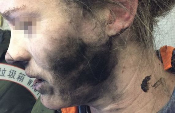 ފްލައިޓް ތެރޭގައި ހެޑްފޯނެއް ގޮވައި މޫނު ފިހިއްޖެ