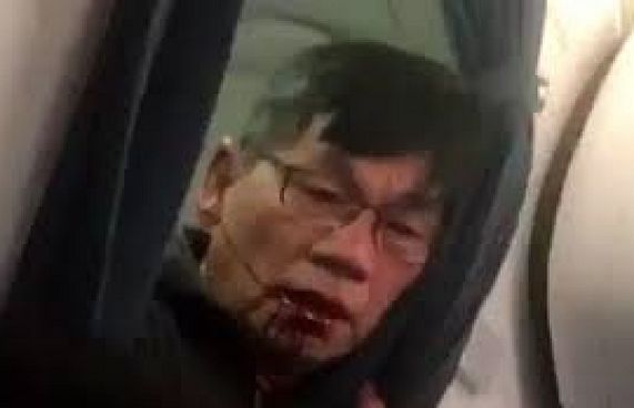 ގަދަކަމުން ބޯޓުން ބޭލި މީހާގެ ދެ ދަތް ވަނީ ބިނދިފައި