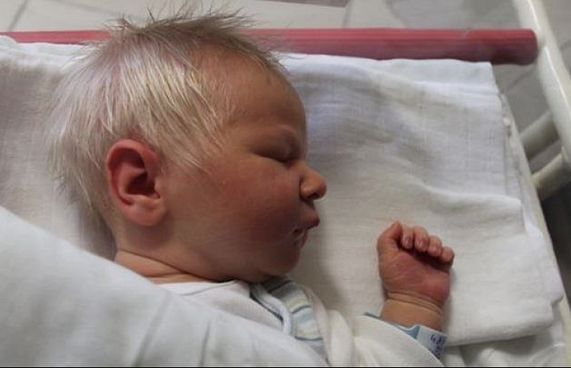 އުފަންވިއިރު ވެސް ބޮލުގައި ހުސް ނުރަ