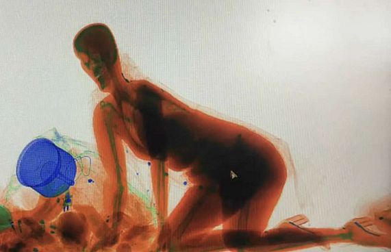 އަތްދަބަހާއެކު ޗައިނާ މީހަކު އެކްސްރޭ މެޝިނަށް ވަދެއްޖެ