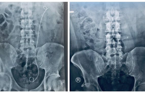 އަދީބު ގެއަށް ބަދަލުކުރުމަށް ވަނީ ލަފާދީފައި: އާއިލާ