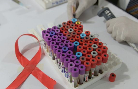 ތިން އަހަރުގެ ތެރޭގައި ހަ މީހަކަށް އެއިޑްސް ޖެހުނު