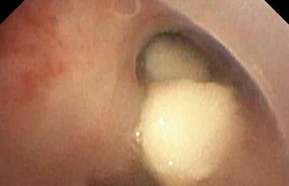 ނޭވާހޮޅީގައި ކެޝޫނަޓެއް ތާށިވެ، ނުރައްކާވެއްޖެ