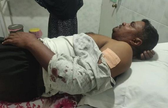 މިލަންދޫ ކައުންސިލަރަކަށް ހަމަލާދީ ޒަހަމްކޮށްލައިފި