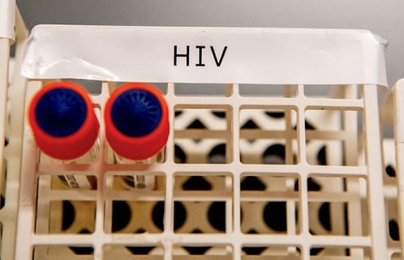 އެއިޑްސް:ދިރިއުޅުމުގެ ވައްޓަފާޅިން ދިފާއީ ނިޒާމު ބަލިވޭ