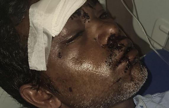 ކޮޗިންގައި ހިނގި އެކްސިޑެންޓުގައި ދިވެއްސަކަށް އަނިޔާ