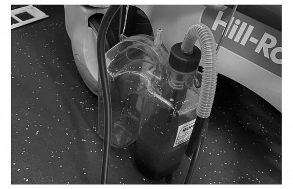 ވޭޕްކުރުމުން ފުއްޕާމޭ ފަޅައިގެންދޭ: މުހައްމަދު އަލީ