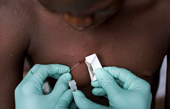 މަންކީޕޮކްސްގެ "އެންމެން" އެއްޖިންސުން ގުޅުން ހިންގާ