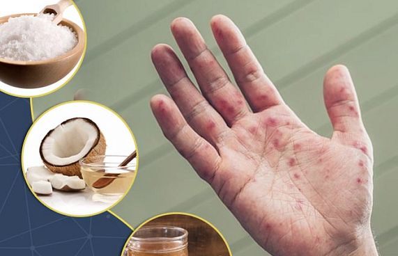 ފާނަބަސަންދާއި ހޭންޑް ފުޓް އެންޑް މައުތު އިތުރުވަނީ