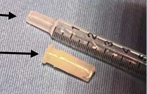 ކުޑަކުއްޖެއްގެ ފުއްޕާމެއިން ނެގީ ކުޅޭ އެއްޗެއްގެ ބައެއް