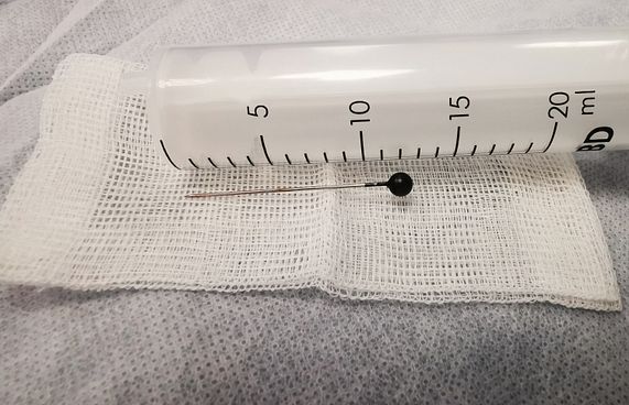 އަންހެން ކުއްޖެއްގެ ނޭވާހޮޅިން ބޮޑު ޕިނެއް ނަގައިފި