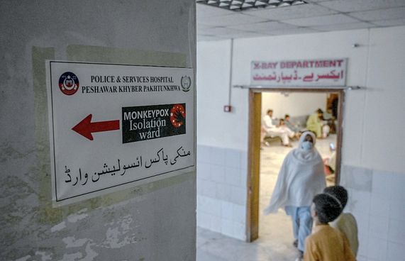 "އެމްޕޮކްސް ފެތުރޭ ބޮޑު ސަބަބަކީ ގައިގައި ބީހުން"