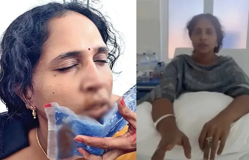 ދަރިވަރު އަނިޔާކުރި ޓީޗަރުގެ ނޭފަތް ބިނދިފައި!