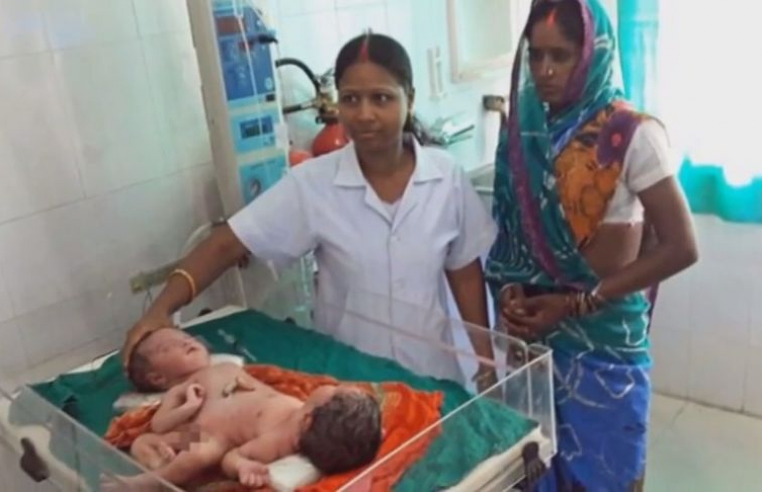 ހަށިގަނޑުން ގުޅިފައިވާ ދެ ކުދިންގެ ކައިރީގައި އެ ކުދިންގެ މަންމަ ޝިވްރާޖޯ ދޭވީ ނަރުހަކާ އެކު މަޑުކޮށްލައިގެން