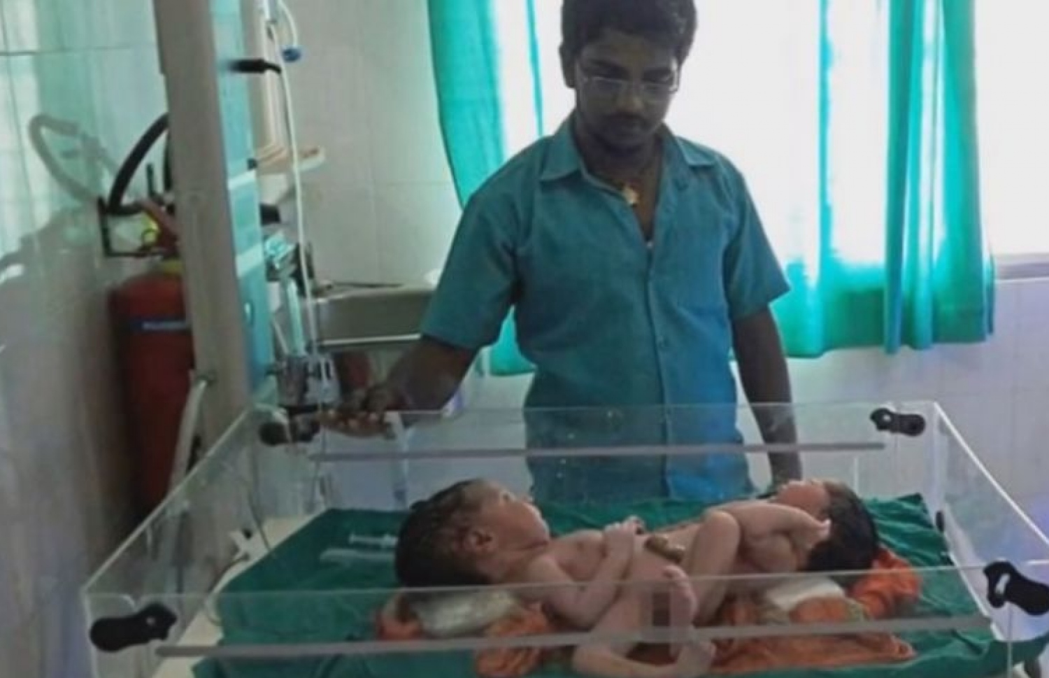 ހަށިގަނޑުން ގުޅިފައިވާ ދެބެންގެ ކައިރީގައި އެ ކުދިންގެ ބައްޕަ ސިންހް