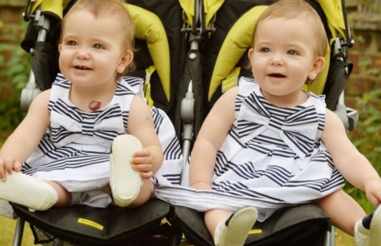 އެއް ހަށިގަނޑުން ގުޅުނު ދެ ކުދިން އޮޕަރޭޝަނަށް ފަހު ފުރަތަމަ އުފަން ދުވަސް ފާހަގަކުރަނީ. --ފޮޓޯ:ބީބީސީ