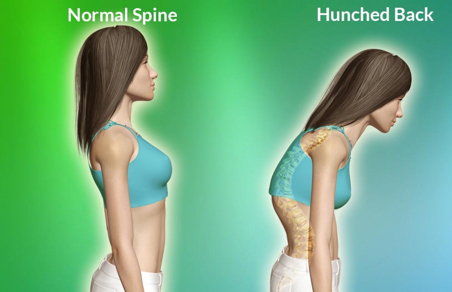 އާދައިގެ މީހެއްގެ މައިބަދަ ހުންނަ ގޮތާއި ހަންޗްޑް ބެކް ނުވަތަ ގުދު ލުމުން ހުންނަ ގޮތް