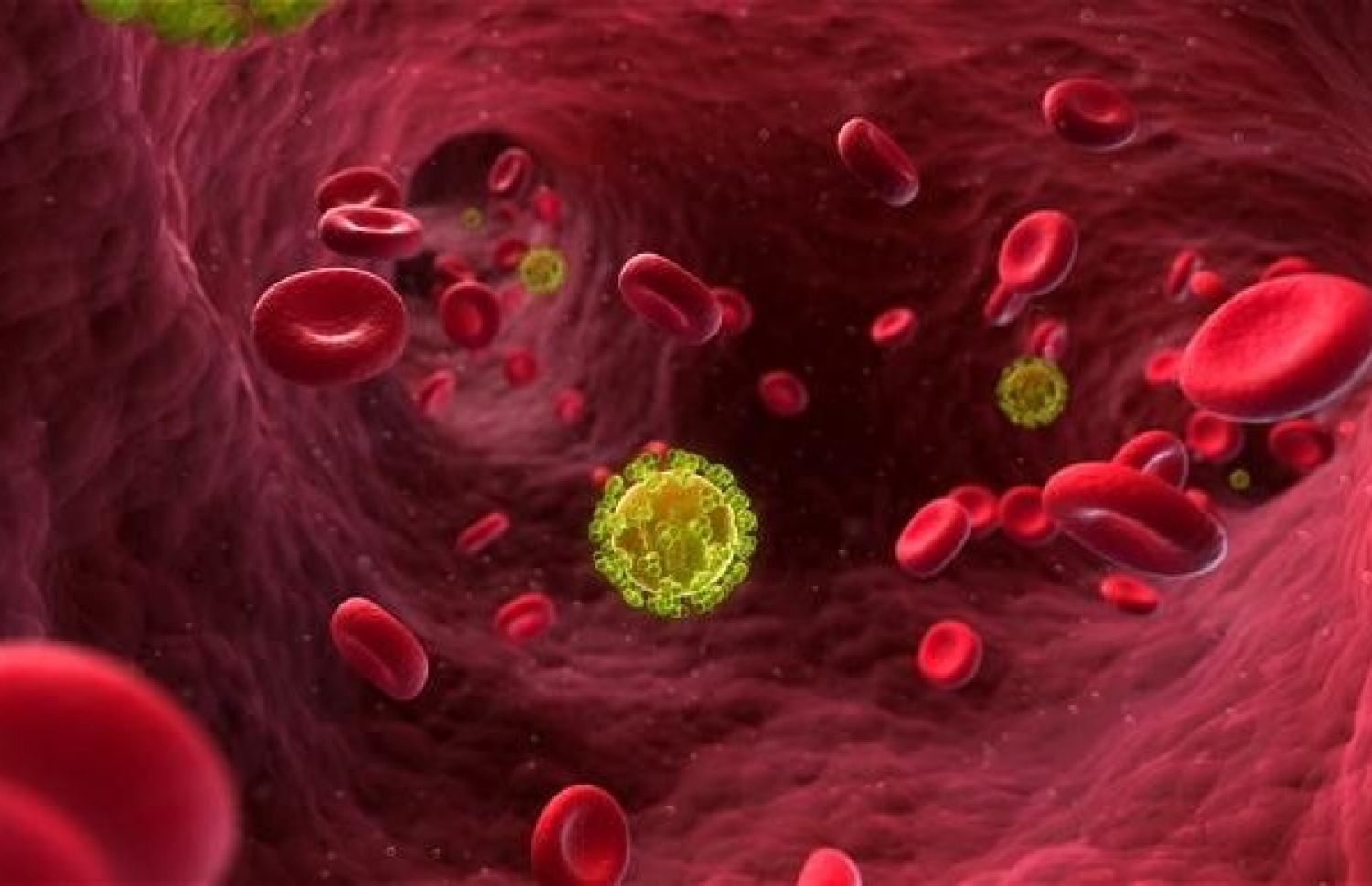 ލޭގެ ތެރޭގައި އެޗްއައިވީ ވައިރަސް ދައުރުވަނީ