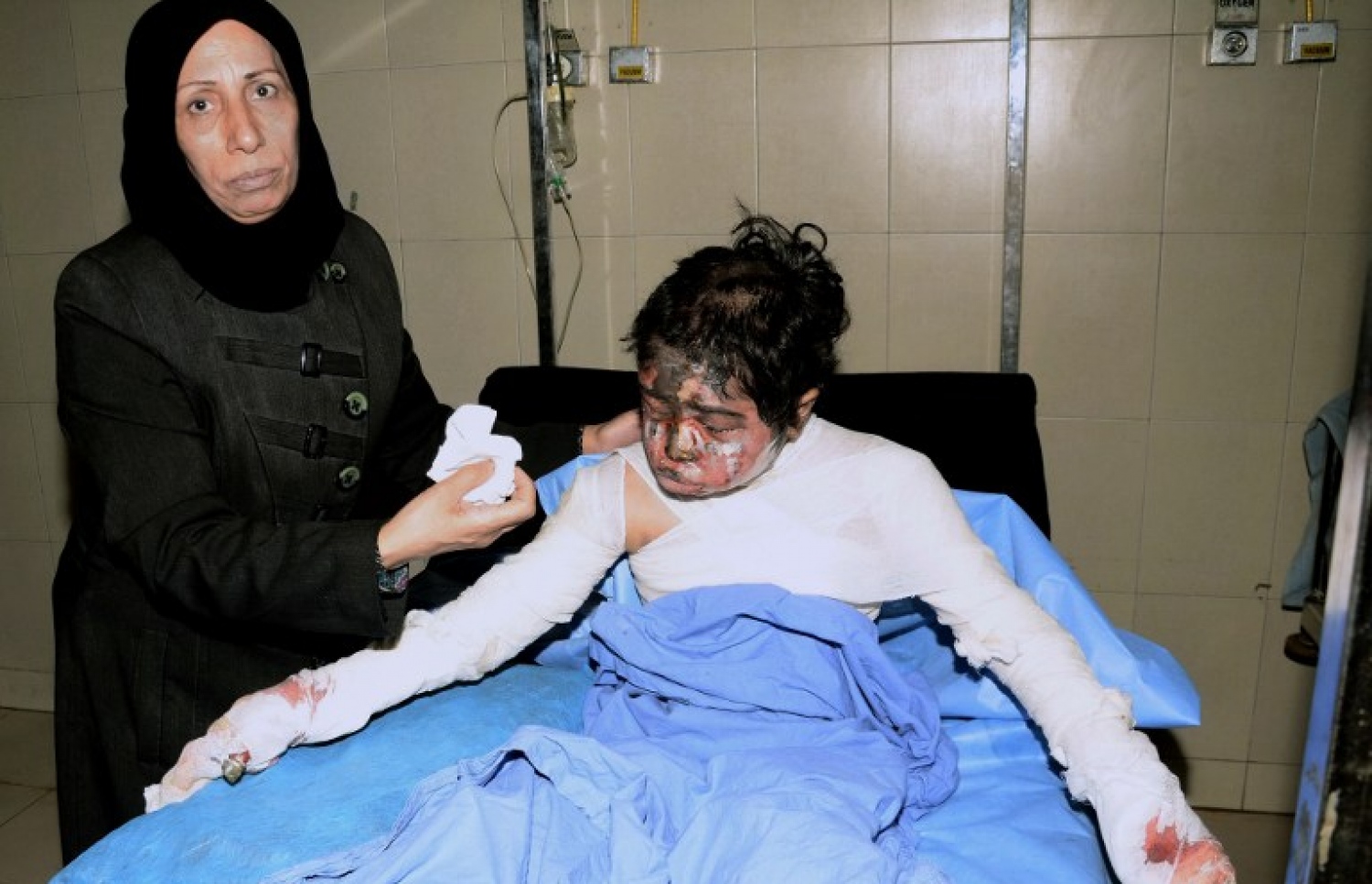 ހަލަބުގެ ހަނގުރާމައިގައި ޒަޚަމްވި ކުއްޖަކަށް ސީރިއާގެ ހޮސްޕިޓަލެއްގައި ފަރުވާ ދެނީ. --ފޮޓޯ:އޭއެފްޕީ