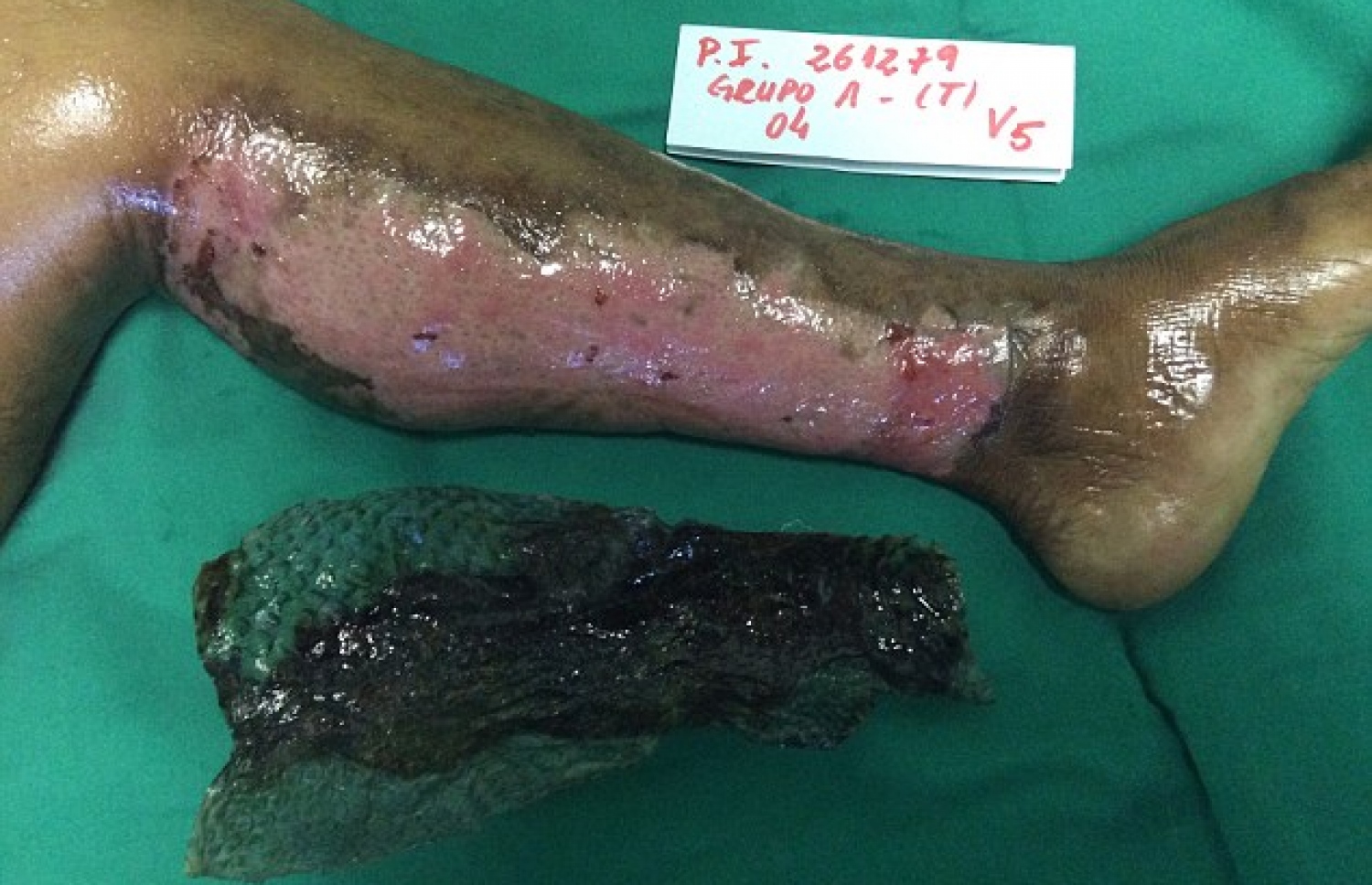 ފިހުނު ތަނުގައި މަހެއްގެ ހަންގަނޑު އަޅައިގެން ފަސޭހަވެފައި