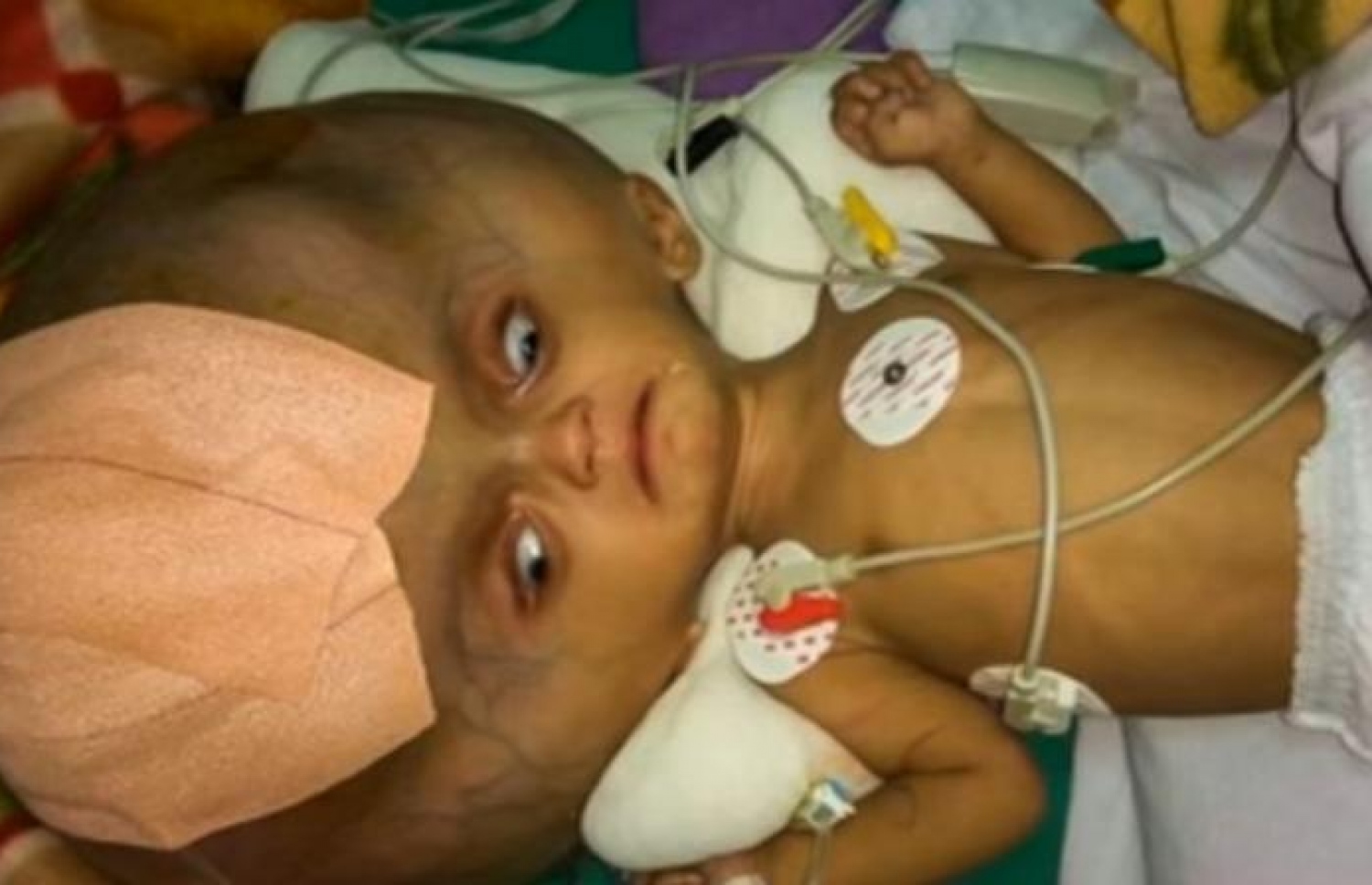 ތުއްތު މިރުތިޔޫންޖޭ ހޮސްޕިޓަލުގައި