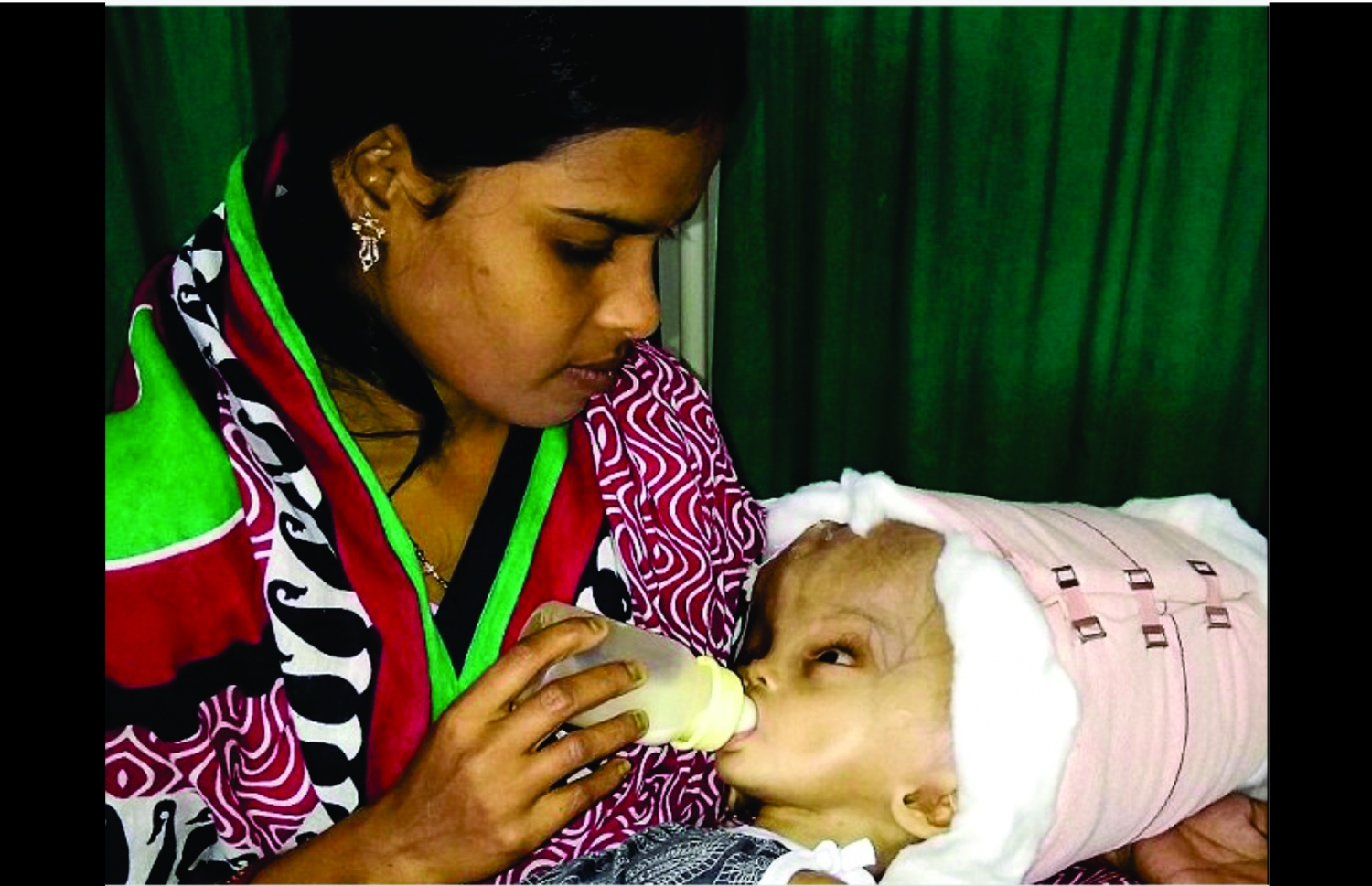 ތުއްތު މިރްތުންޖޭ އޮޕަރޭޝަނަށްފަހު މަންމަގެ އުނގުގައި