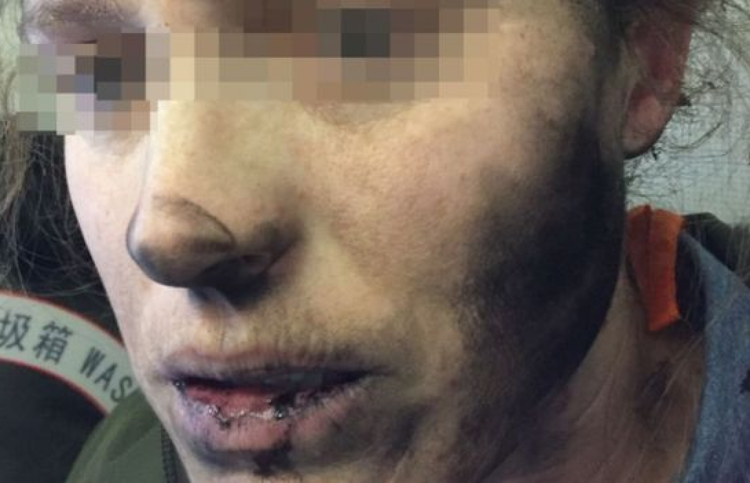 ހެޑްފޯނު ގޮވުމުން ފްލައިޓުގައި އިން އަންހެން މީހާގެ މޫނު ފިހިފައި.