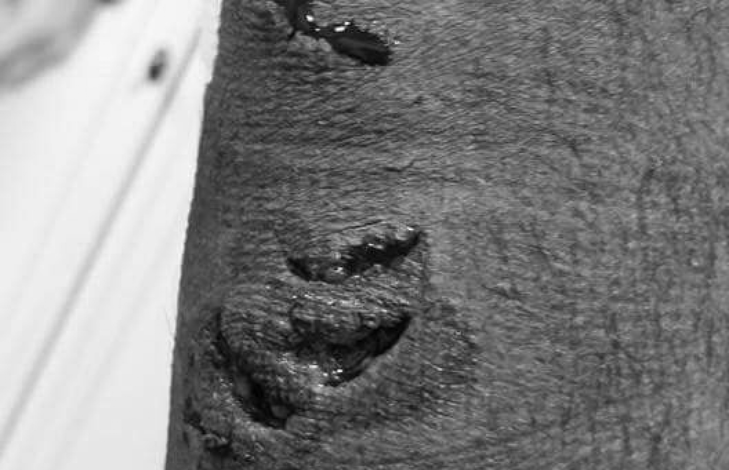 މިޔަރުގެ ހަމަލާގައި ލިބިފައިވާ ޒަހަމްތައް.-- ފޭސްބުކް ފޮޓޯ: އިއްލަތު ހަސަން