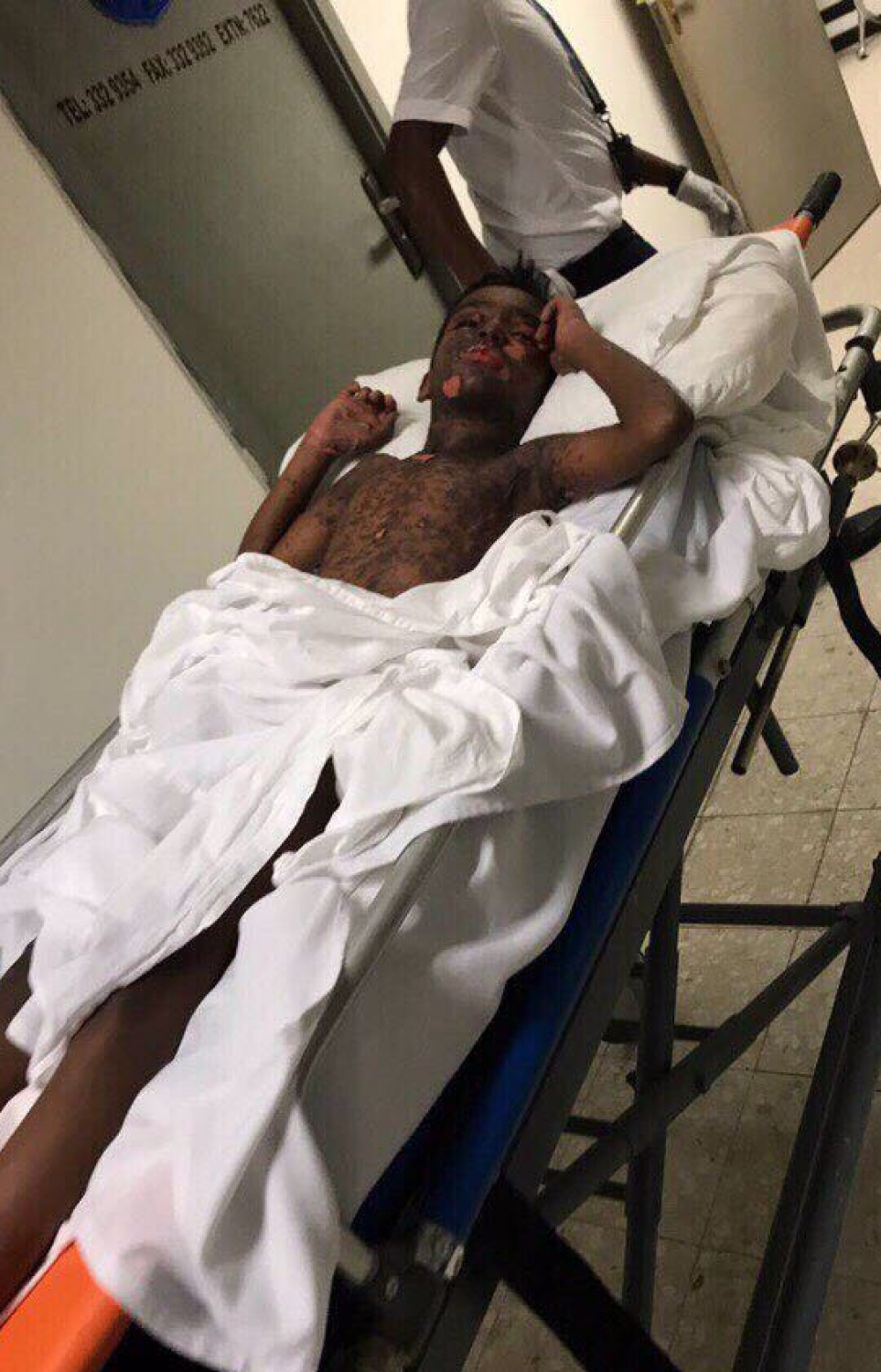 ހުން އައިސްގެން ފަރުވާ ހޯދި ކުއްޖާގެ ހަށިގަނޑުން ފޮޅުތައް ނަގާފައި. ސްރީ ލަންކާގައި ފަރުވާ ދެމުން އަންނަ މި ކުއްޖާގެ ހާލު މިހާރު އަންނަނީ ރަނގަޅުވަމުން.