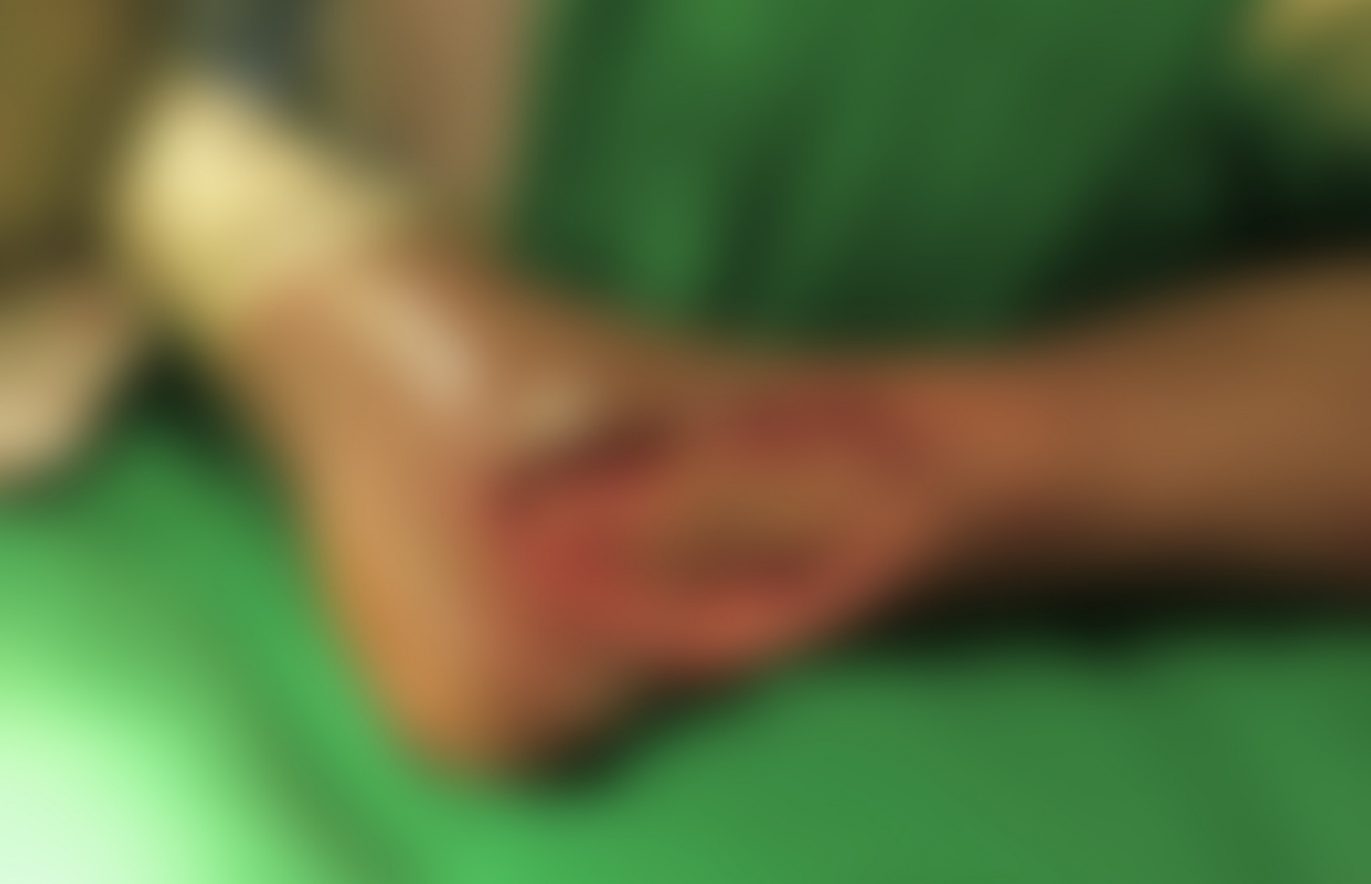 އަލަމްގެ ފައިގެ ބައެއް ގިރިފައި