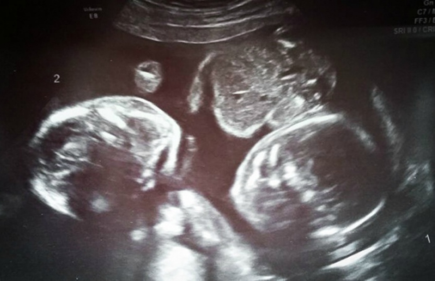 ދެބެއިންގެ ފުރާނަ ސަލާމަތްވީ ބަނޑުތެރޭގައި ހަރަކާތެއް ނެތި އެއް ކުއްޖަކު އަނެއް ކުއްޖެއްގެ ގައިގައި ބައްދާލައިގެން ތިބުމުން.