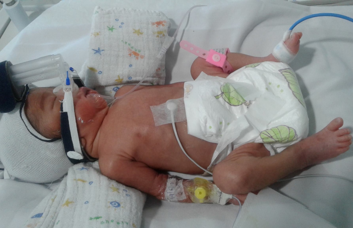 ދުވަސް ނުފުރާ ވިހޭ ކުއްޖަކު އައިޖީއެމްއެޗުގައި. ފޮޓޯ: އައިޖީއެމްއެޗް