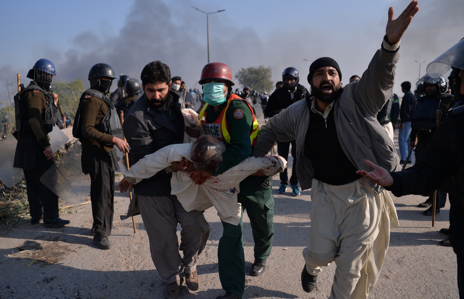 ހުވާގެ އިބާރާތުގެ މައްސަލާގައި މުޒާހަރާ ކުރަމުންދާ ޕާކިސްތާނުގެ ތަހްރީކީ ލައްބައިކަ ޕާޓީގެ ޒަޚަމްވެފައިވާ މީހަކު ގެންދަނީ. --ފޮޓޯ:އޭއެފްޕީ