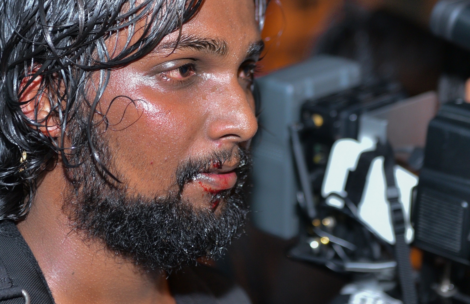 މާލެ: ފެބްރުއަރީ 16، 2018- އިދިކޮޅު ފަރާތްތަކުން މިރޭ މާލޭގައި ބޭއްވި އެއްވުން ރޫޅާލުމަށް ފުލުހުން އާދަޔާ ޚިލާފަށް ބާރުގެ ބޭނުން ކުރުމުގެ ސަބަބުން، ސަންގު ޓީވީގެ ކެމެރާމަނެއްގެ އަނގަމަތި ފަޅައިގެން ގޮސްފައި.---ފޮޓޯ: ހުސެއިން ވަހީދު/މިހާރު