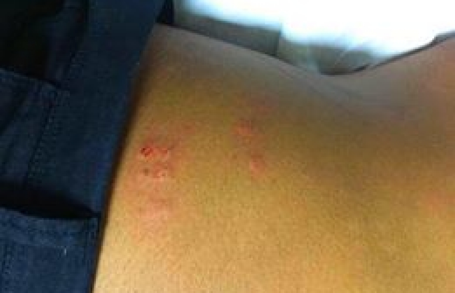 މާލެ: ފެބްރުއަރީ 16، 2018- އިދިކޮޅު ފަރާތްތަކުން ބޭއްވި އެއްވުން ރޫޅާލުމުގެ ތެރެއިން ހައްޔަރުކުރި، ރާއްޖެ ޓީވީގެ ނޫސްވެރިޔާ ހުސެއިން ހަސަންގެ ވާތު އަރިކަށިމަތިން ލޭ ކޮށައިގެން ގޮސްފައި: އޭނާ އަށް ފުލުހުން އަނިޔާކޮށްފައިވާ ހުސެއިން ބުނޭ.