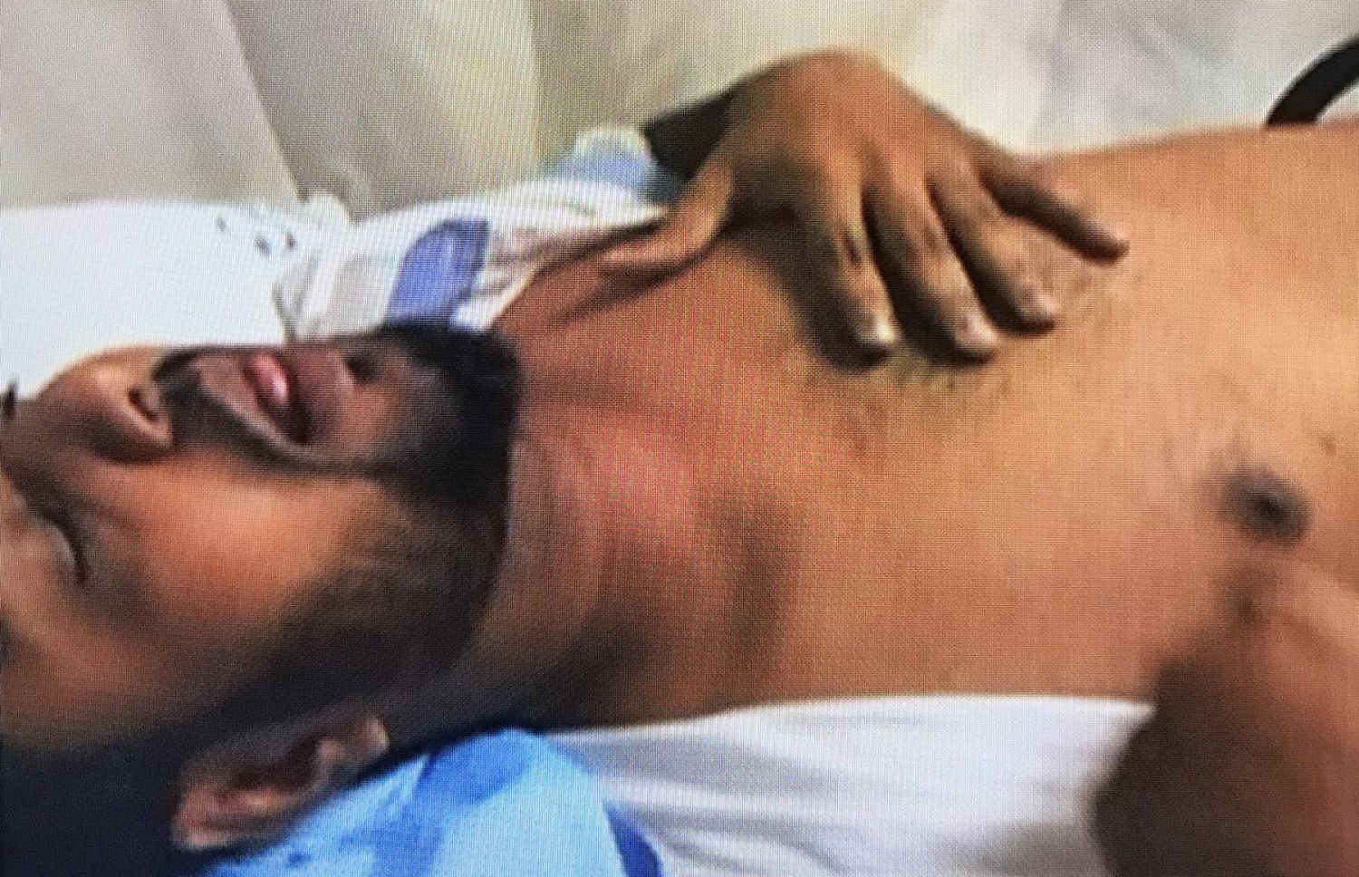 ހުސައިން ރޭ އޭޑީކޭގައި އެޑްމިޓްކޮށްފައިވާ އިރު، އޭނާގެ ކަރު ތާށިކޮށްލުމުގެ ސަބަބުން ދޫ ނުކުމެފައި.