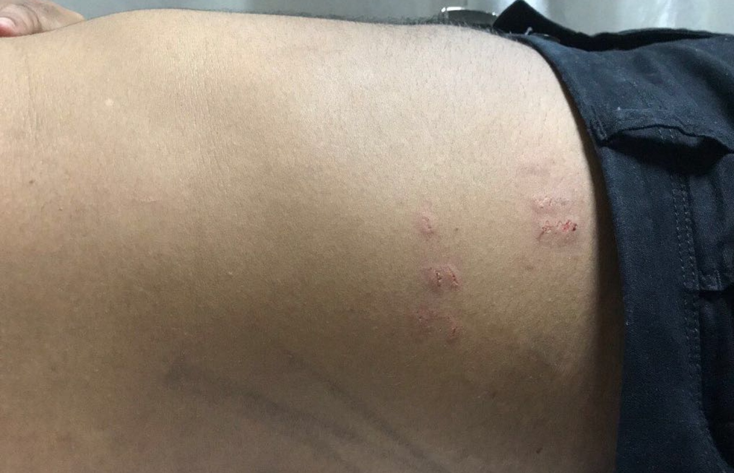 މާލެ: ފެބްރުއަރީ 16، 2018- އިދިކޮޅު ފަރާތްތަކުން ބޭއްވި އެއްވުން ރޫޅާލުމުގެ ތެރެއިން ހައްޔަރުކުރި، ރާއްޖެ ޓީވީގެ ނޫސްވެރިޔާ ހުސެއިން ހަސަންގެ ވާތު އަރިކަށިމަތިން ލޭ ކޮށައިގެން ގޮސްފައި: އޭނާ އަށް ފުލުހުން އަނިޔާކޮށްފައިވާ ހުސެއިން ބުނޭ.