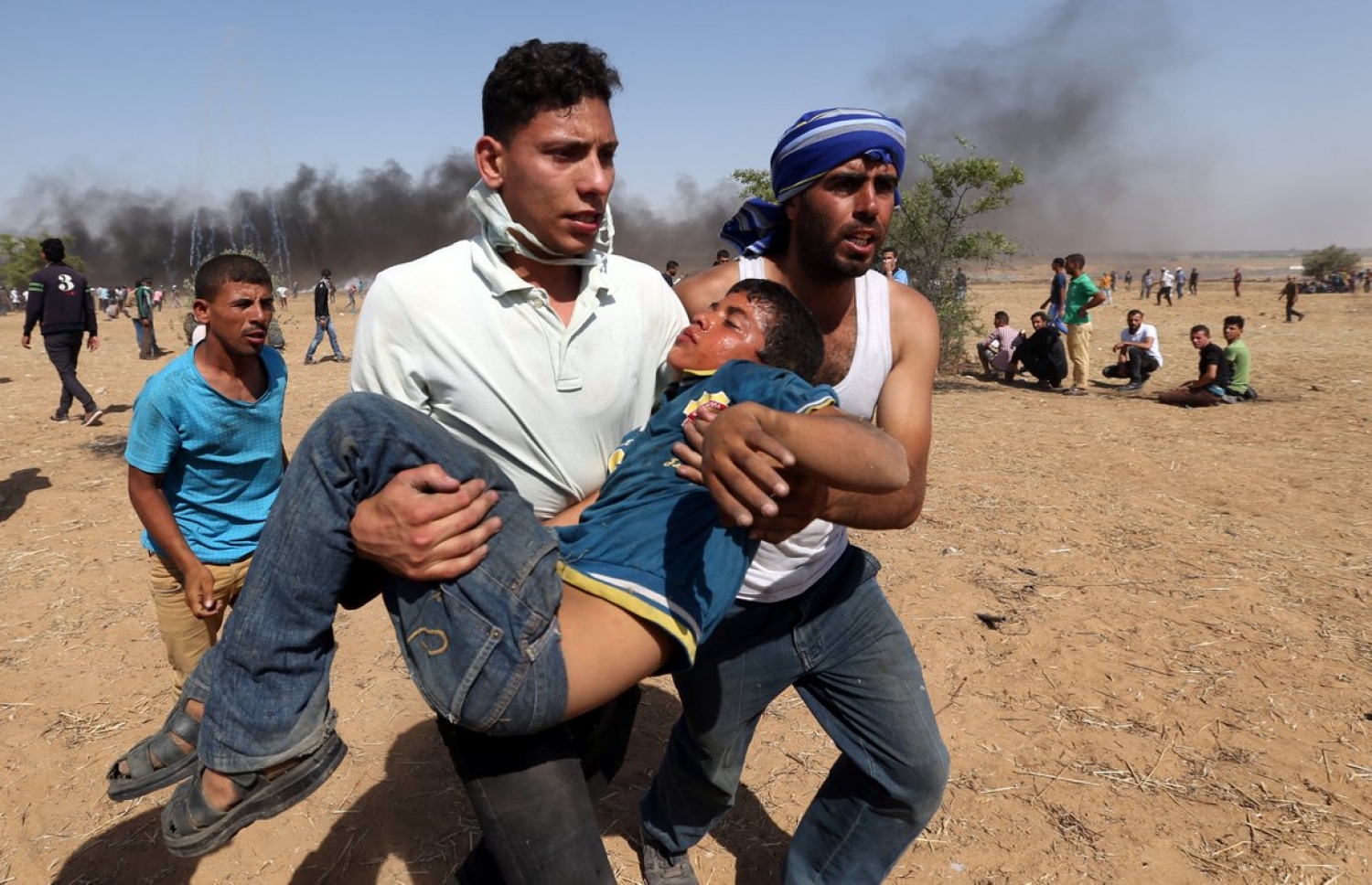 އިޒްރޭލުގެ އަޅުވެތިކަމާ ދެކޮޅަށް ފަލަސްތީނު ރައްޔިތުން ފަށައިގެން މިހާރު ކުރަމުންދާ ސިލްސިލާ މުޒާހަރާތަކުގެ ތެރެއިން އިއްޔެގެ މުޒާހަރާ ހުއްޓުވުމަށް އިޒްރޭލު ސިފަައިން ދިން ހަމަލާގައި ޒަޚަމްވި ފަލަސްތީނު ކުޑަކުއްޖަކަށް ފަރުވާ ދިނުމަށް ގެންދަނީ. --ފޮޓޯ އަލްޖަޒީރާ