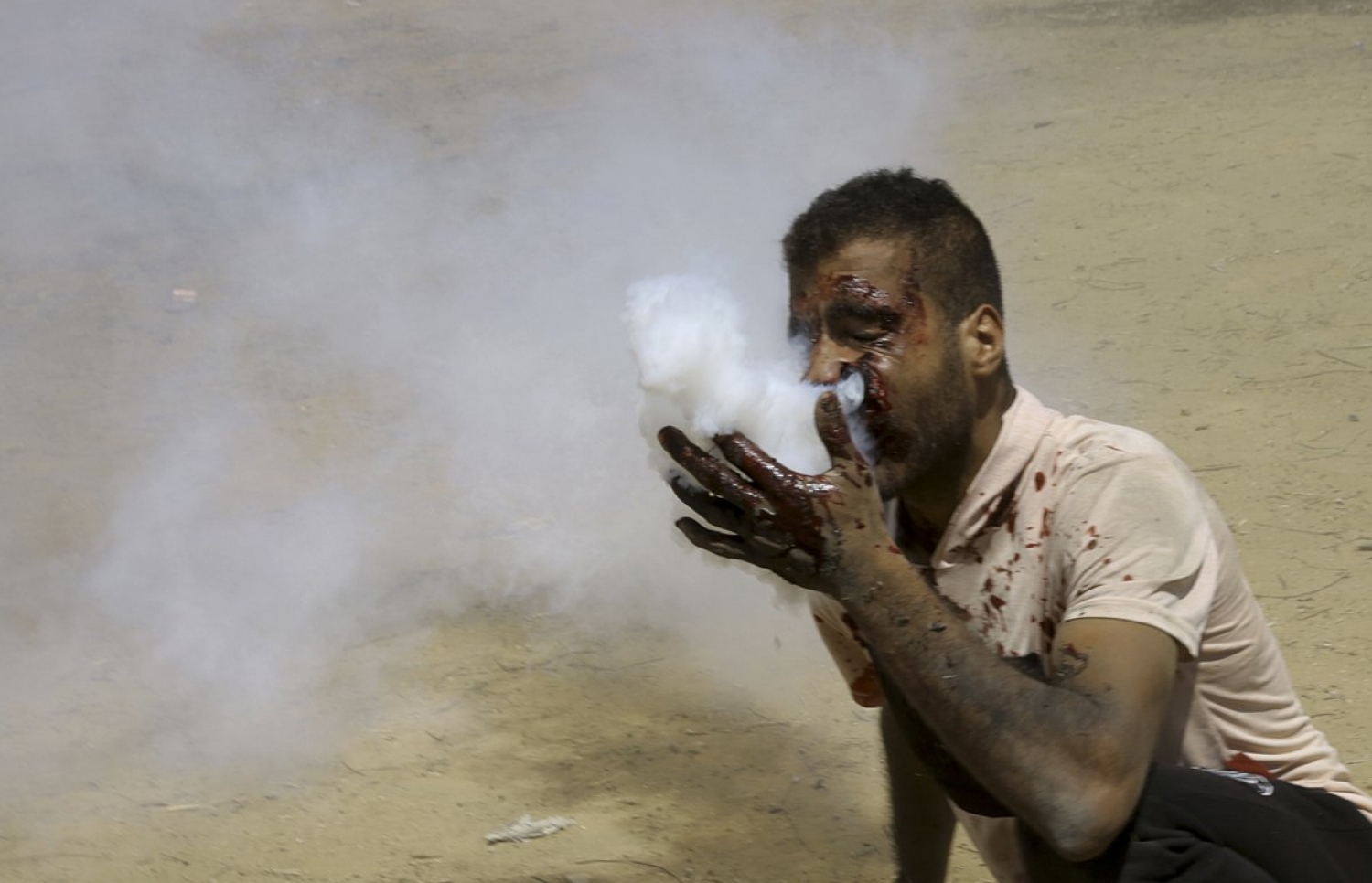 އިޒްރޭލުގެ އަޅުވެތިކަމާ ދެކޮޅަށް ފަލަސްތީނު ރައްޔިތުން ފަށައިގެން މިހާރު ކުރަމުންދާ ސިލްސިލާ މުޒާހަރާތަކުގެ ތެރެއިން އިއްޔެގެ މުޒާހަރާ ހުއްޓުވުމަށް އިޒްރޭލު ސިފަައިން ދިން ހަމަލާގައި ފަލަސްތީނު މީހެއްގެ މޫނުމައްޗަށް ގޭސް ދަޅެއް ގޮވަނީ. --ފޮޓޯ އަލްޖަޒީރާ