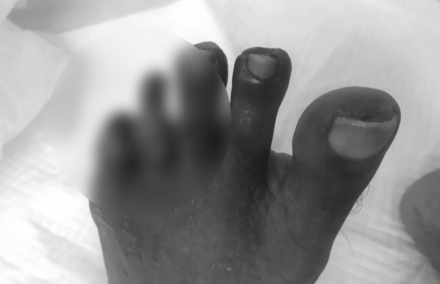 ނާފިއުގެ ވައަތު ފައިގެ އިނގިލިތައް ވެސް ގިރެން ފަށާފައި.