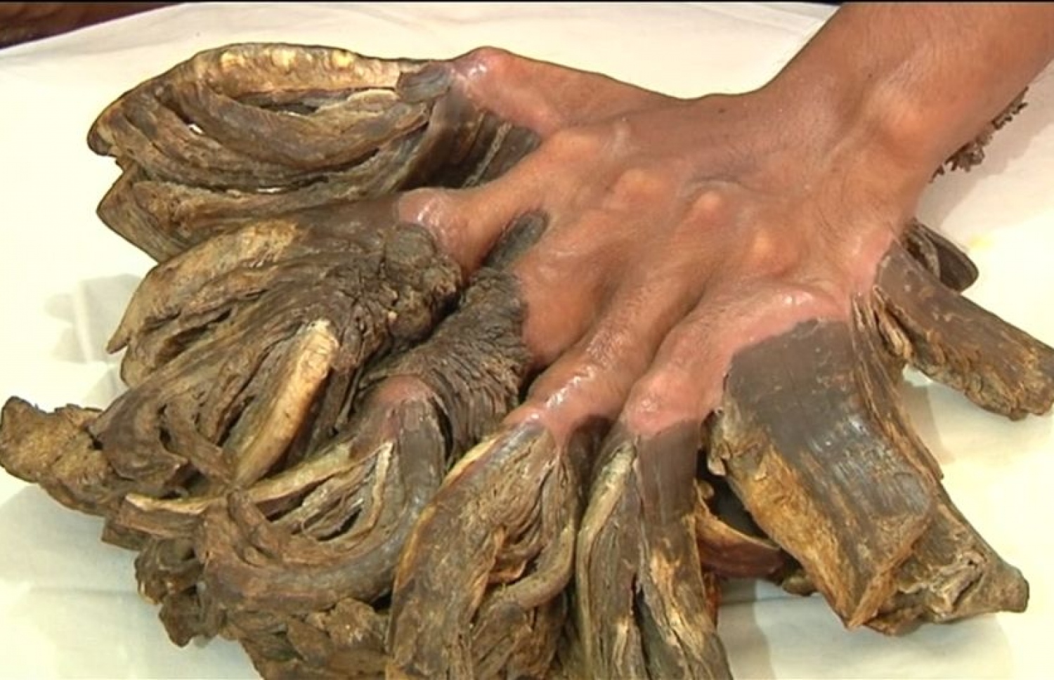 އަތުގެ އިނގިލިތަކުގައި އުފެދިފައިވާ އެއްޗެހިތައް