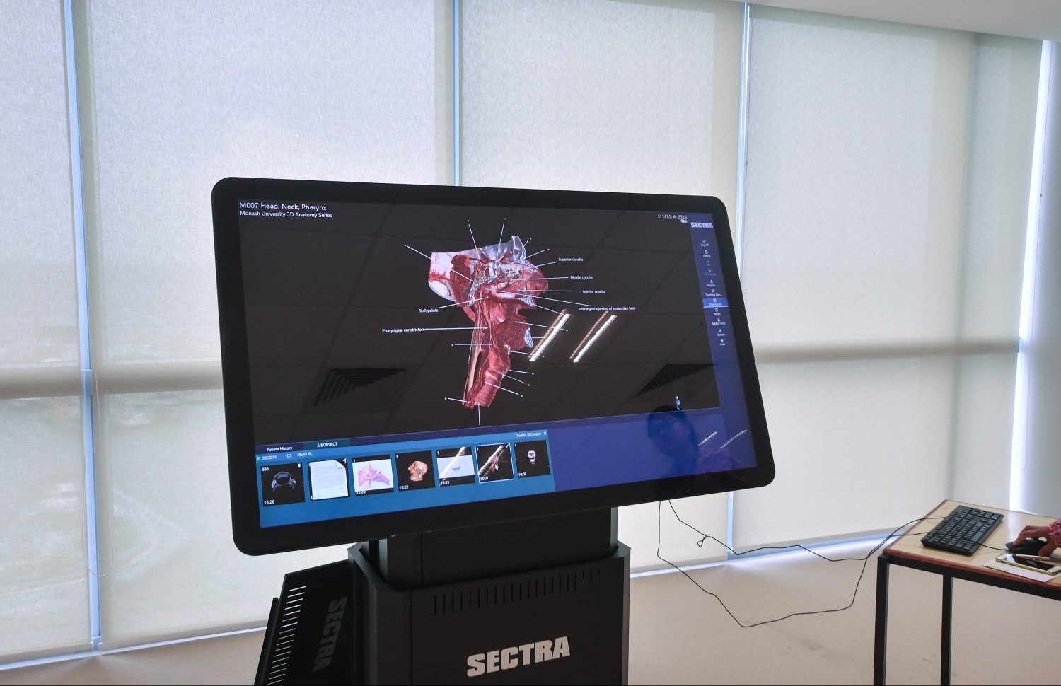 ވާޗުއަލް ޑިސެކްޝަން ޓޭބަލް: އޭގައި އިންސާނާގެ ހަށިގަނޑުގެ ފުރިހަމަ މައުލޫމާތު ހިމެނޭ --ފޮޓޯ: ހުސެއިން ވަހީދު/ މިހާރު