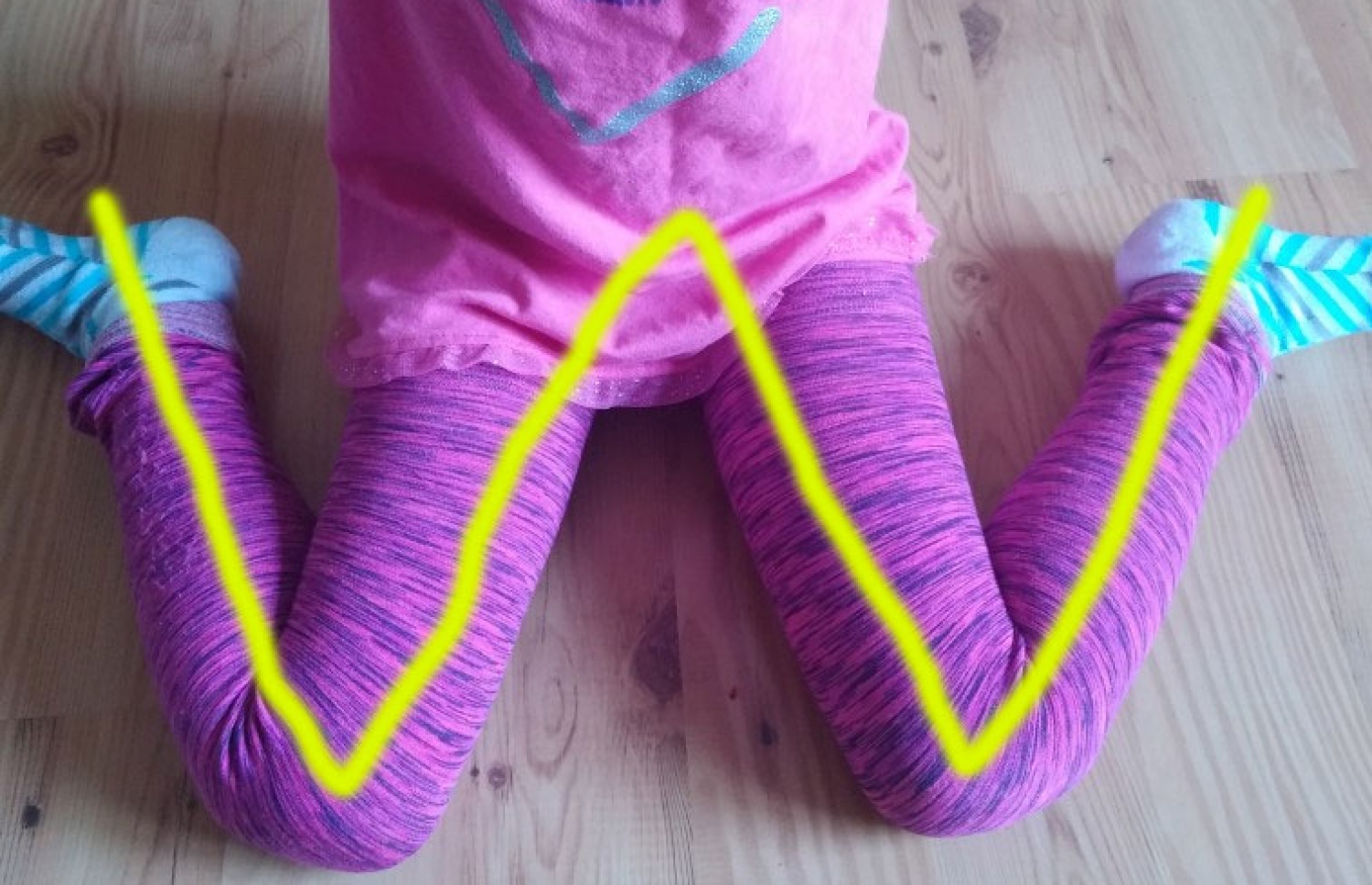 ކުއްޖަކު "ޑަބްލިއު" ސިޓިން ޕޮޒިޝަނުގައި.