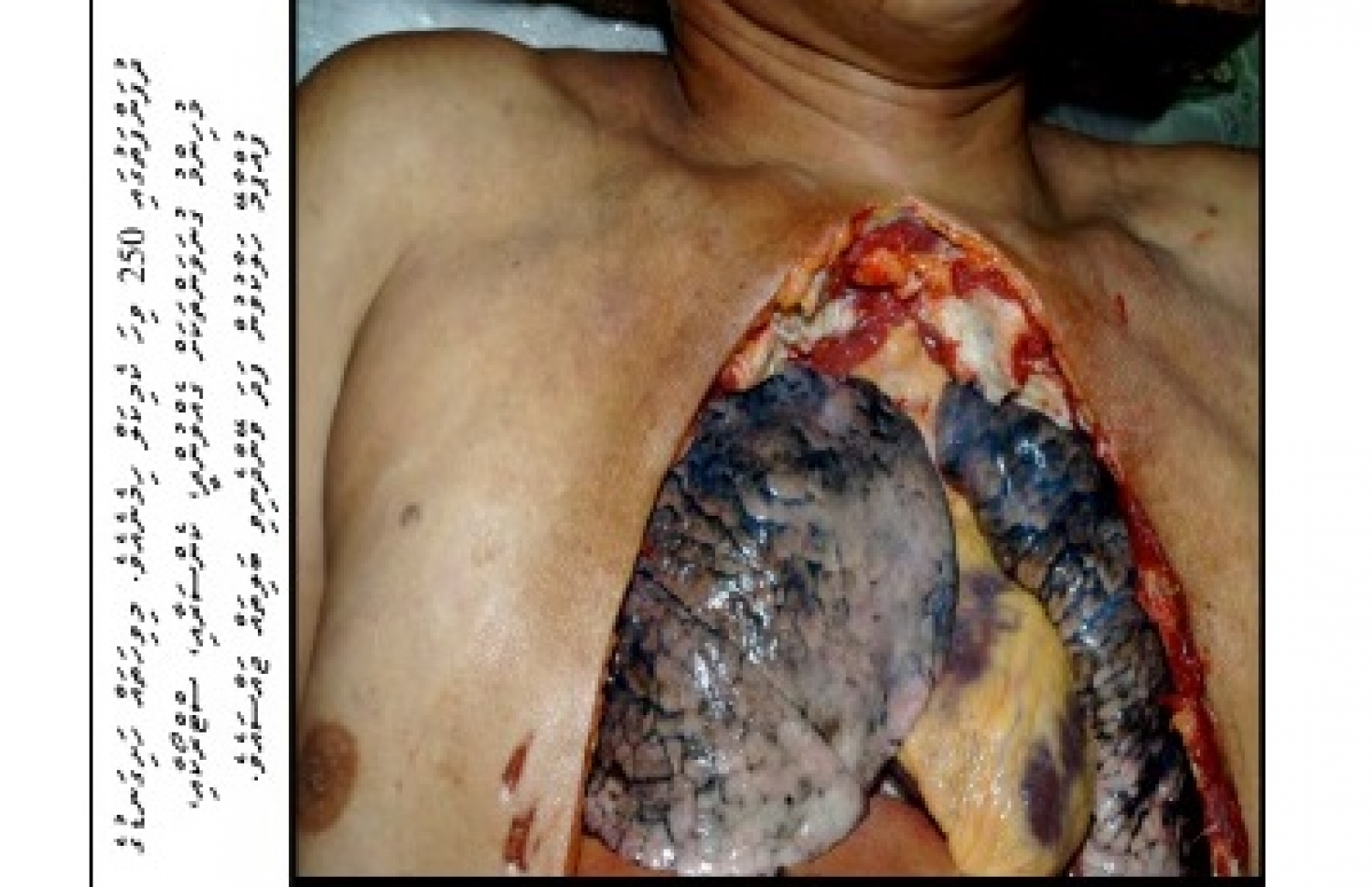 ސިނގިރޭޓު ފޮށީގެ ބޭރުގައި ޖަހަން ނިންމާފައިވާ އިންޒާރުގެ ފޮޓޯ.