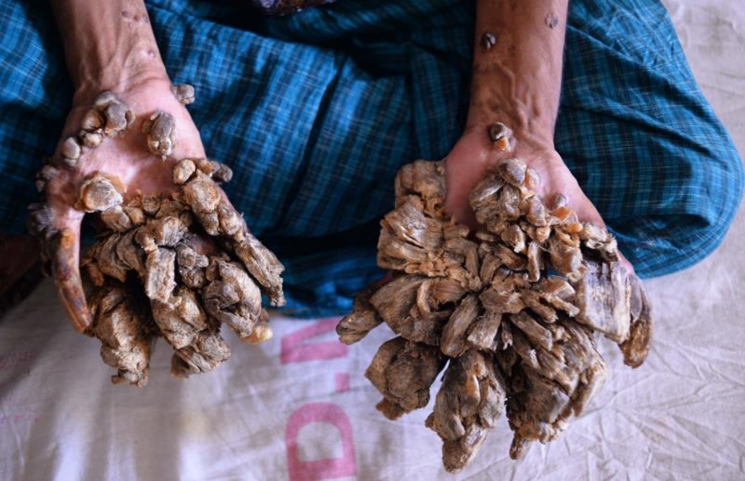 ބަޖަންދަރު އަތް ދައްކައިލަނީ.