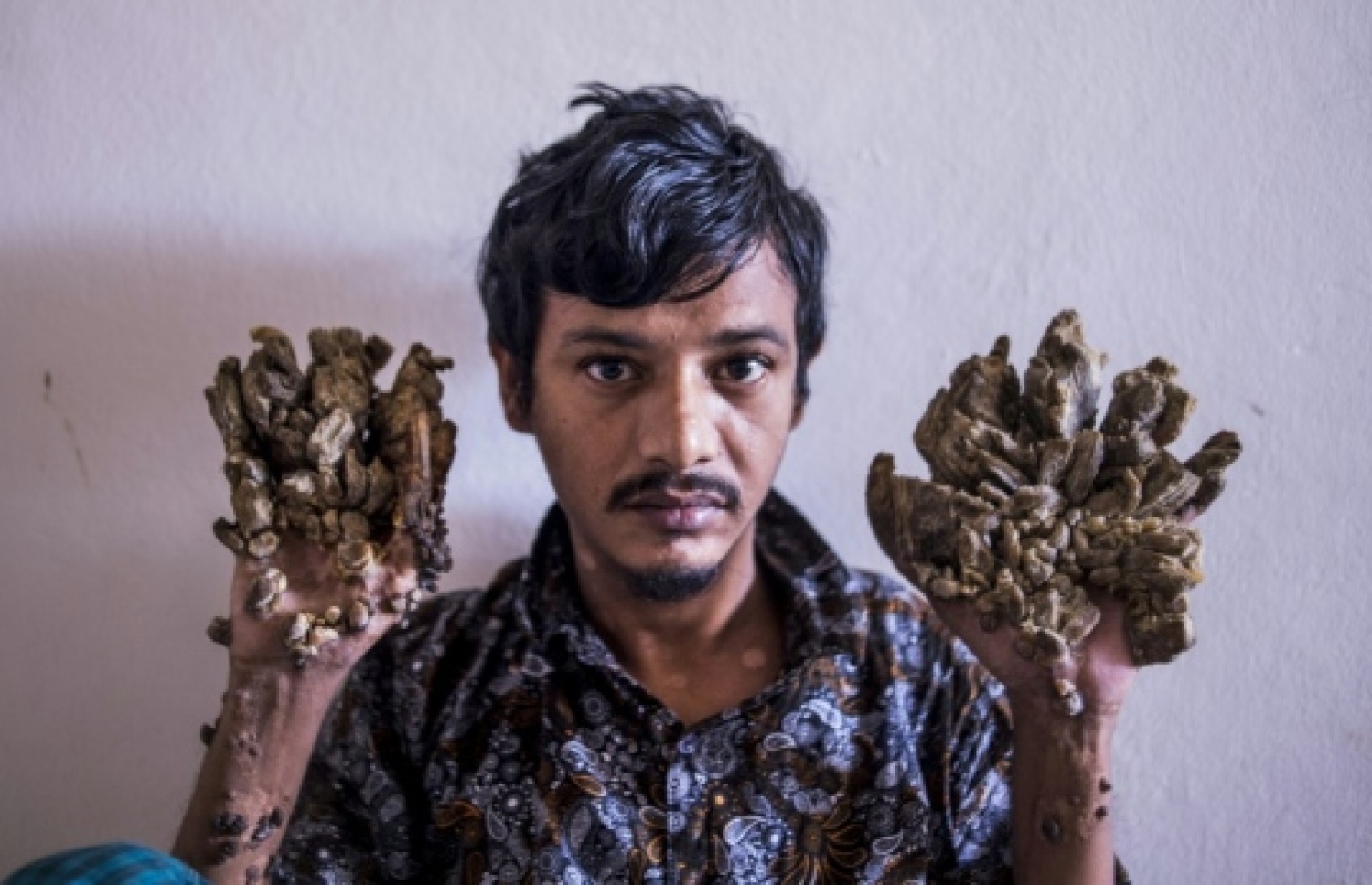 ބަޖަންދަރު ހޮސްޕިޓަލްގައި އަތް ދައްކައިލަނީ.