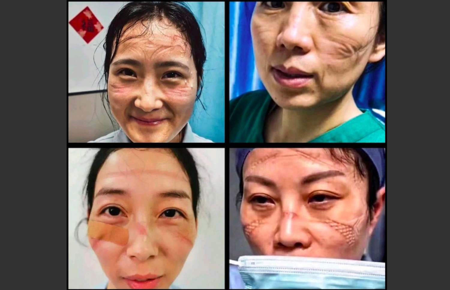 ޗައިނާގެ ސިއްހީ ހިދުމަތްތެރިންތަކެއްގެ މޫނުގައި މާސްކްގެ ނިޝާންތައް